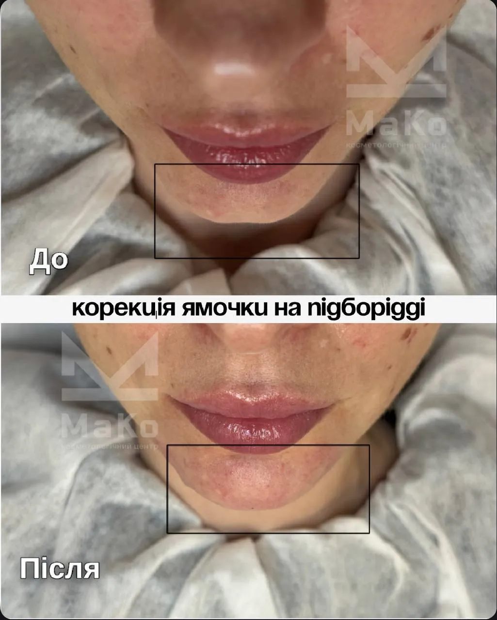 Філери Філери