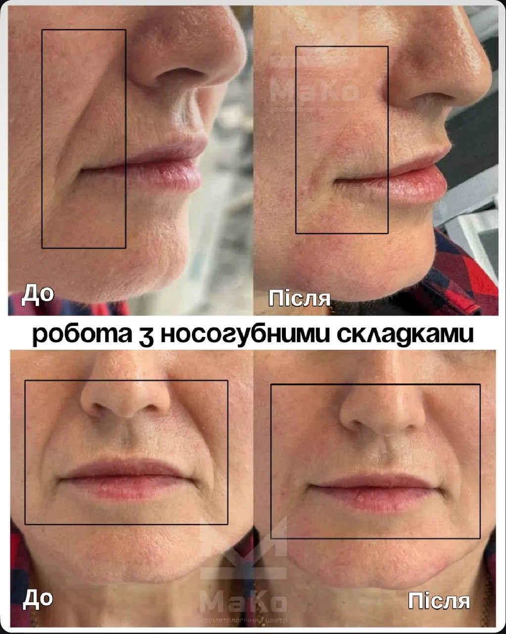 Філери Філери